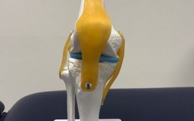 Knie artrose fysiotherapie