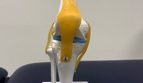 Knie artrose fysiotherapie